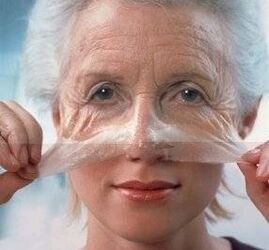 Омоложение кожи лица с лазером