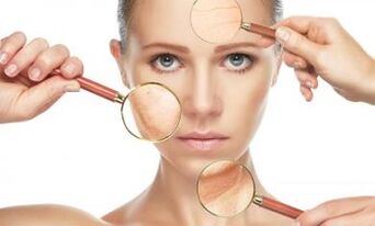 Какие проблемы с кожей может решить фракционное лазерное омоложение